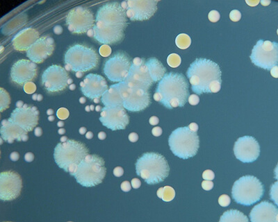microorganisms and disease lesson contents